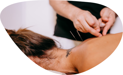 Une praticienne ptratiquant l'acupuncture